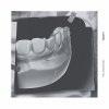 Lorn - Album Ghosst(s)